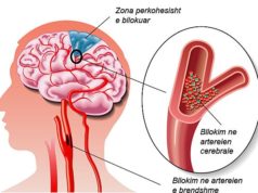 Goditja ne tru. 3 keshilla si te shpetoni nje jete