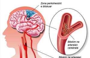 Goditja ne tru. 3 keshilla si te shpetoni nje jete