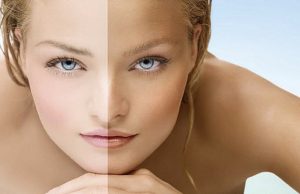 10 këshilla për të mbrojtur lëkurën tuaj nga dielli