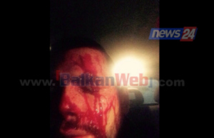 Piket e dhena kane qene shkaku i goditjes se Flori Mumajesit