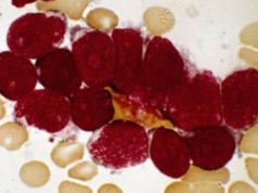 A mund te jete kjo kura ndaj kancerit?