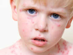 OBSH jep alarmin per fruthin