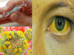 OBSH: Ja semundja qe po shkakton me shume vdekje se AIDS