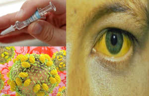 OBSH: Ja semundja qe po shkakton me shume vdekje se AIDS