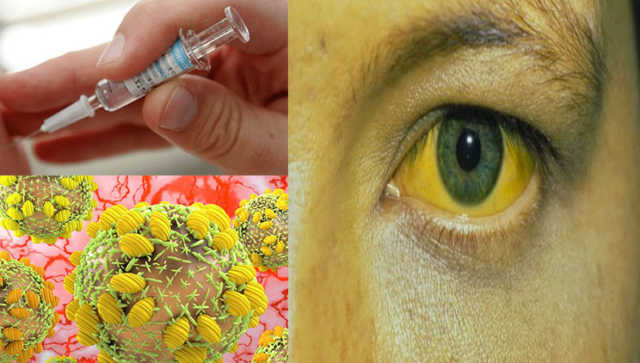 OBSH: Ja semundja qe po shkakton me shume vdekje se AIDS