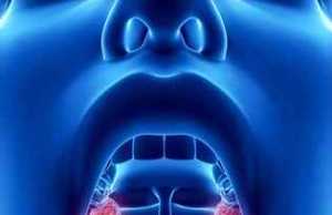 Mishi i huaj ne hunde dhe bajamet. Ja kur duhen operuar