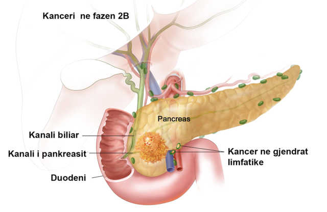 pankreasi