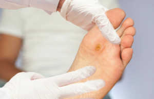 Myku i kembeve, ekzema dhe kallot, ja si ti kurojme