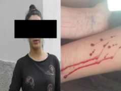 14-vjeçarja rrëfen tmerrin: Shpoja veten me brisk e gozhdë