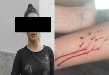 14-vjeçarja rrëfen tmerrin: Shpoja veten me brisk e gozhdë