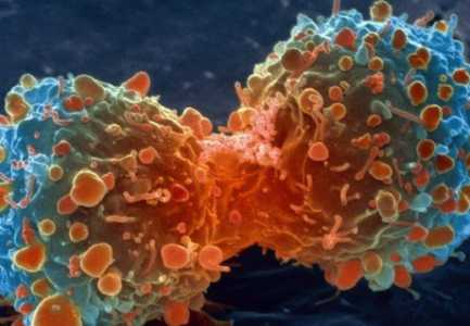 10 shenjat e kancerit që të gjithë i injorojmë!