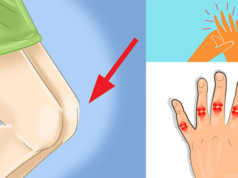 Çfare jane “Spondiloartropatite”, semundjet qe prekin gjymtyret, shenjat e hershme