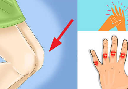 Çfare jane “Spondiloartropatite”, semundjet qe prekin gjymtyret, shenjat e hershme