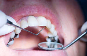 Rreziqet qe vijne nga mbushjet e zeza