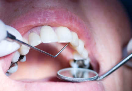 Rreziqet qe vijne nga mbushjet e zeza